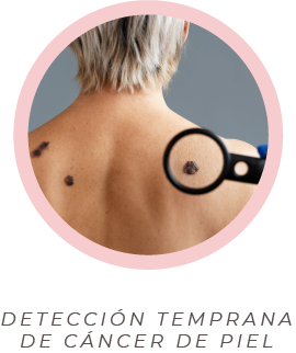 Lipomas