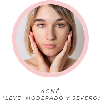Peeling y despigmentantes