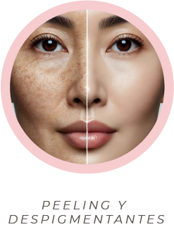 Peeling y despigmentantes